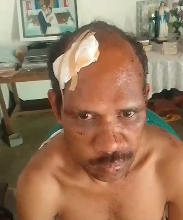 IMG_20240826_204718 Ket. Foto Korban Agustinus Honin