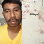 Pemilik Kos Aniaya Warga TDM II Hingga Tak Sadarkan Diri, Keluarga Korban Merasa Ditipu Dengan Cerita Jatuh Dari Tangga