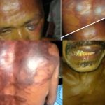 Miris Oknum TNI Aniaya Warga Sipil Babak Belur, Aktivis Kemanusiaan Alor Akan Kawal