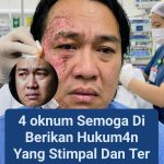 Terdapat Perbedaan Pengungkapan Pelaku Anatar TNI-Polri Dalam Kasus Penyiraman Air Keras Kepada Andry Yunus