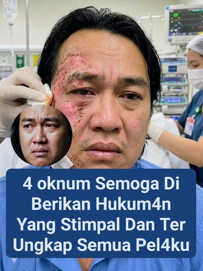 Terdapat Perbedaan Pengungkapan Pelaku Anatar TNI-Polri Dalam Kasus Penyiraman Air Keras Kepada Andry Yunus